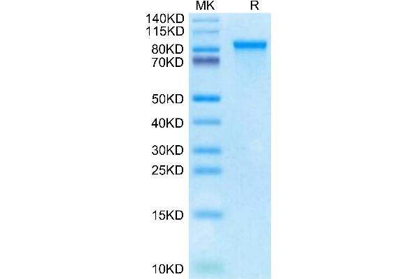 MMP 9 Protein (AA 20-706) (His tag)