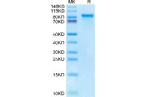 Cynomolgus MMP-9 on Tris-Bis PAGE under reduced condition. (MMP 9 Protein (AA 20-706) (His tag))