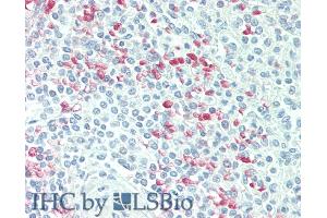 Detection of CDKN2D in Human Spleen Tissue using Polyclonal Antibody to Cyclin Dependent Kinase Inhibitor 2D (CDKN2D) (CDKN2D antibody  (AA 1-166))