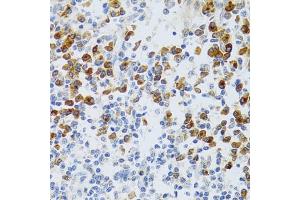 Immunohistochemistry of paraffin-embedded human tonsil using p60 C antibody  at dilution of 1:100 (40x lens). (CHAF1B antibody  (AA 270-559))