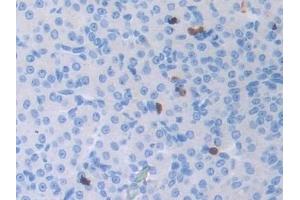 Detection of ATF6 in Mouse Ovary Tissue using Polyclonal Antibody to Activating Transcription Factor 6 (ATF6) (ATF6 antibody  (AA 1-377))