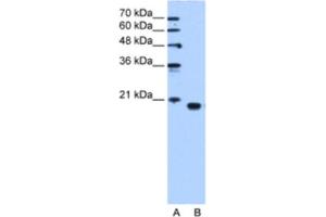 Western Blotting (WB) image for anti-Phosphatidylethanolamine Binding Protein 1 (PEBP1) antibody (ABIN2463157) (PEBP1 antibody)