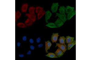 ABIN6257600 and ABIN6275123 staining Hela cells(45 min of heat-shock) by IF/ICC. (EIF5B antibody  (C-Term))