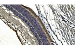 IHC analysis of PDE6 alpha/PDE6A using anti-PDE6 alpha/PDE6A antibody (ABIN7599710). (PDE6A antibody  (AA 11-237))