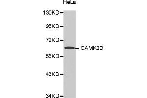 Western blot analysis of extracts of HeLa cells, using CAMK2D antibody (ABIN5970243).
