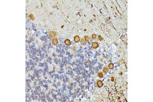 Immunohistochemistry of paraffin-embedded mouse cerebellum using K/K/Elp3 antibody (ABIN6130883, ABIN6140142, ABIN6140143 and ABIN6225217) at dilution of 1:100 (40x lens). (ELP3/KAT9 antibody  (AA 358-547))