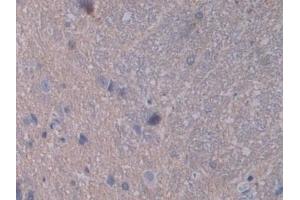 Immunohistochemistry (IHC) image for anti-Signal Transducer and Activator of Transcription 2, 113kDa (STAT2) (AA 587-838) antibody (ABIN7443368)