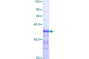 DNASE2 Protein (AA 261-360) (GST tag)