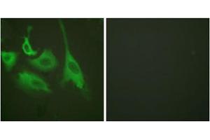 Immunofluorescence analysis of HeLa cells, treated with TNF-a (20nM, 15mins), using HSP90B (phospho-Ser254) antibody (ABIN5975888). (HSP90AB1 antibody  (pSer254))