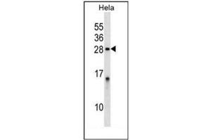 Western Blotting (WB) image for anti-Protein Phosphatase 1, Regulatory (Inhibitor) Subunit 2 (PPP1R2) (AA 118-148), (Middle Region) antibody (ABIN954271)