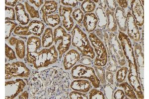 ABIN6272923 at 1/100 staining Human kidney tissue by IHC-P. (LGALS3BP antibody  (C-Term))