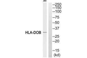 Western blot analysis of extracts from 293 cell, using HLA-DOB antibody. (HLA-DOB antibody  (N-Term))