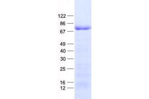 Validation with Western Blot (FOXO4 Protein (His tag))