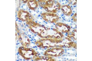 Immunohistochemistry of paraffin-embedded Mouse kidney using [KO Validated] CHCHD2 Rabbit pAb (ABIN7266448) at dilution of 1:100 (40x lens). (CHCHD2 antibody  (AA 75-145))