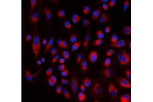 IF analysis of ALDH1A2 using anti-ALDH1A2 antibody (ABIN4886449).