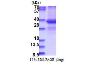 SDS-PAGE (SDS) image for DEAD (Asp-Glu-Ala-Asp) Box Polypeptide 39A (DDX39) (AA 1-249) protein (His tag) (ABIN5853754)
