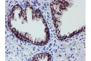 Image no. 3 for anti-Arachidonate 15-Lipoxygenase (ALOX15) antibody (ABIN1496358) (ALOX15 antibody)