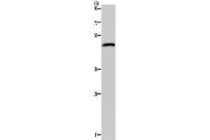Western Blotting (WB) image for anti-Serotonin Receptor 2B (HTR2B) antibody (ABIN5547300) (Serotonin Receptor 2B antibody)