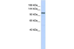 WB Suggested Anti-ADCY8 Antibody Titration:  0. (ADCY8 antibody  (Middle Region))