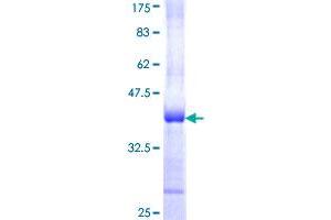 PPP1CA Protein (AA 224-330) (GST tag)