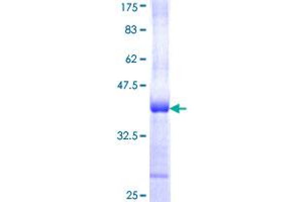 PPP1CA Protein (AA 224-330) (GST tag)