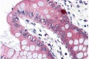 anti-Claudin 5 (CLDN5) (C-Term) antibody