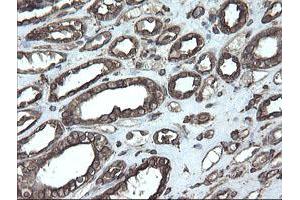 Image no. 1 for anti-Protein Disulfide Isomerase Family A, Member 3 (PDIA3) (AA 140-505) antibody (ABIN1490935) (PDIA3 antibody  (AA 140-505))