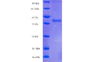 Klk1b22 Protein (AA 25-259) (His-SUMO Tag)