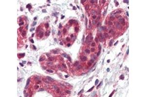 IHC analysis of FFPE human breast tissue stained with SLUG antibody (SLUG antibody  (AA 98-129))