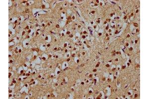 IHC image of ABIN7171755 diluted at 1:100 and staining in paraffin-embedded human brain tissue performed on a Leica BondTM system. (ODZ1/Teneurin 1 antibody  (AA 1-241))