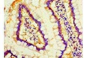 Immunohistochemistry of paraffin-embedded human small intestine tissue using ABIN7160116 at dilution of 1:100 (MOB1A antibody  (AA 2-216))