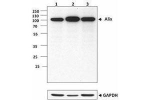 Western Blotting (WB) image for anti-Programmed Cell Death 6 Interacting Protein (PDCD6IP) antibody (ABIN2664052) (ALIX antibody)