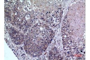Immunohistochemistry (IHC) analysis of paraffin-embedded Human Lung, antibody was diluted at 1:100. (FMO3 antibody  (Internal Region))