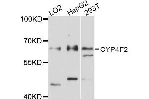 Western blot analysis of extracts of various cells, using CYP4F2 antibody. (CYP4F2 antibody)
