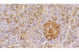 Immunohistochemistry (IHC) image for anti-Epithelial Cell Adhesion Molecule (EPCAM) (AA 25-265) antibody (ABIN7443065)