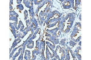 IHC analysis of ICAM1 using anti-ICAM1 antibody (ABIN7601066). (ICAM1 antibody  (AA 28-268))