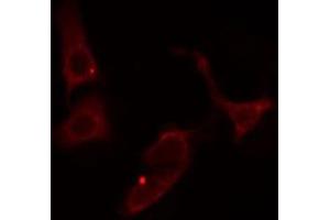 ABIN6274542 staining Hela cells by IF/ICC. (SHPK antibody  (N-Term))