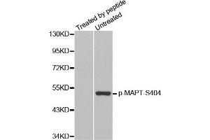 Western Blotting (WB) image for anti-Microtubule-Associated Protein tau (MAPT) (pSer404) antibody (ABIN1870403) (MAPT antibody  (pSer404))