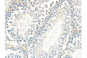 ABIN6265766 and ABIN6268647 at 1/100 staining Rat testis tissue by IHC-P. (TSC1 antibody  (C-Term))