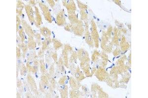 Immunohistochemistry of paraffin-embedded Rat heart using EIF2S1 Polyclonal Antibody at dilution of 1:100 (40x lens). (EIF2S1 antibody)