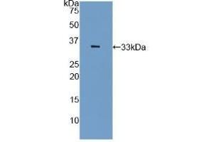 Detection of Recombinant PAI2, Rat using Polyclonal Antibody to Plasminogen Activator Inhibitor 2 (PAI2) (SERPINB2 antibody  (AA 154-408))