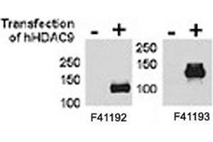HDAC9 antibody  (HDAC9 antibody  (AA 503-533))