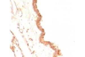 Formalin-fixed, paraffin-embedded rat lung stained with Glypican-3 antibody (GPC3/863) (Glypican 3 antibody)