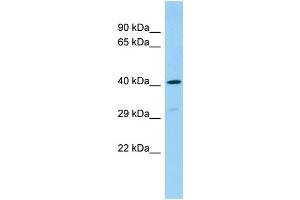 Host: Rabbit Target Name: DEF8 Sample Type: Fetal Heart lysates Antibody Dilution: 1.