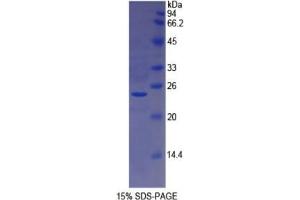 SDS-PAGE analysis of Human PMP22 Protein. (PMP22 Protein (AA 31-133) (His tag,SUMO Tag))