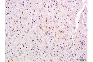 Formalin-fixed and paraffin-embedded rat brain labeled with Rabbit Anti-MTNR1A/MTR-1A/MEL-1A-R Polyclonal Antibody, Unconjugated  at 1:300 followed by conjugation to the secondary antibody (Melatonin Receptor 1A antibody  (AA 201-280))