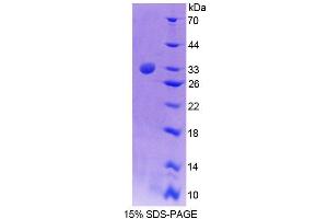 SDS-PAGE analysis of Mouse TEC Protein.