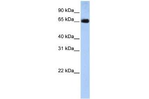 SLC22A13 antibody used at 1 ug/ml to detect target protein.