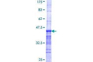 CASC5 Protein (AA 3-98) (GST tag)