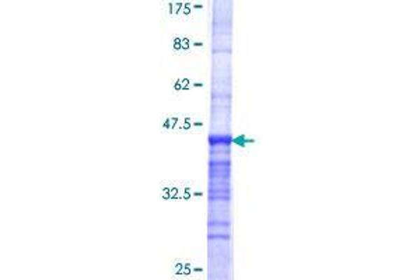 CASC5 Protein (AA 3-98) (GST tag)